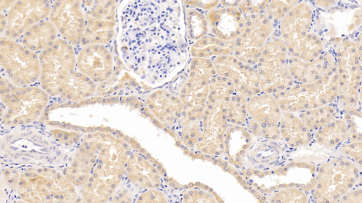 Monoclonal Antibody to Heat Shock Protein 60 (Hsp60)