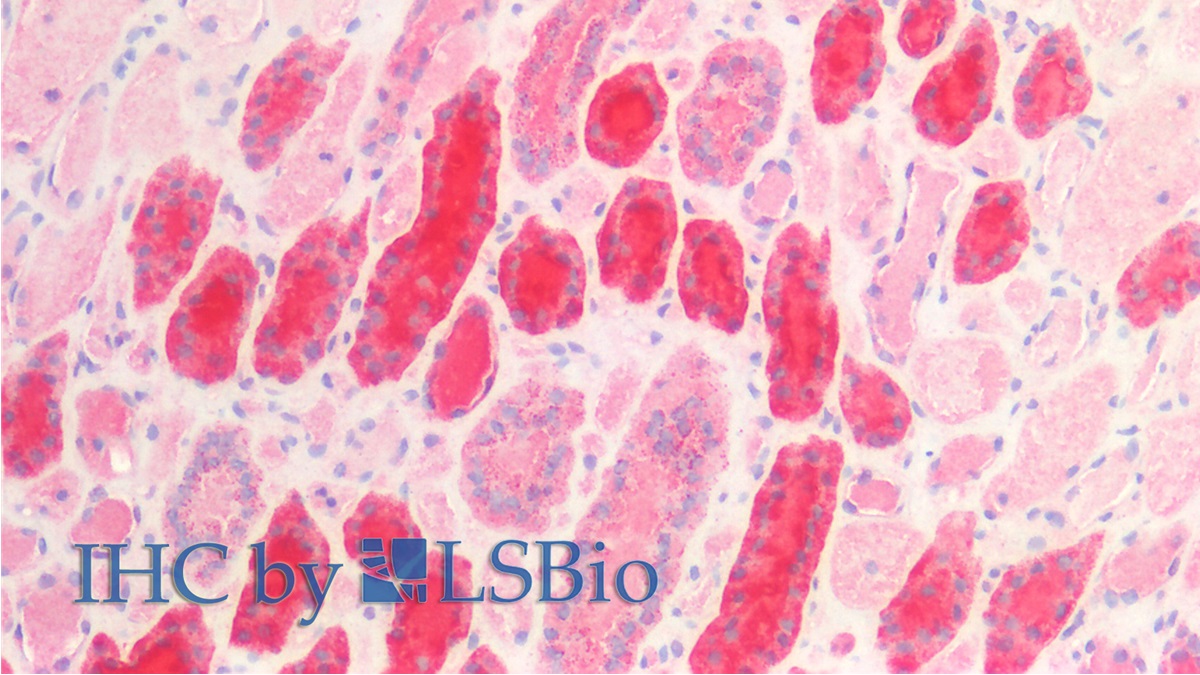 Monoclonal Antibody to Heat Shock Protein 60 (Hsp60)