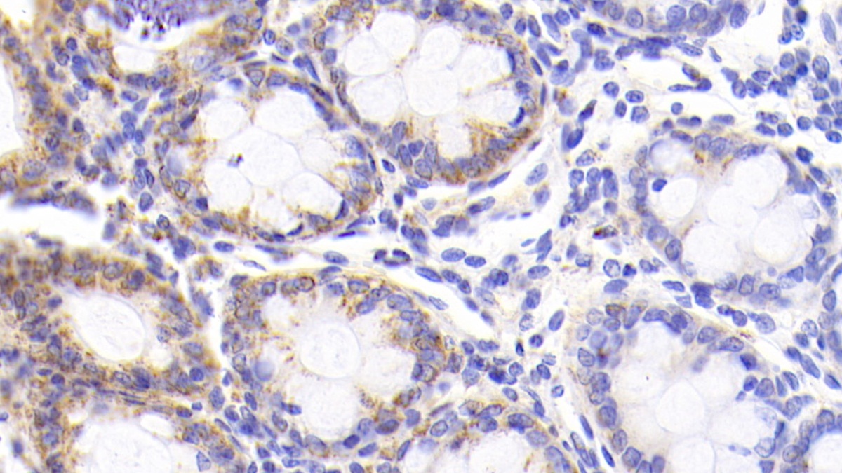 Monoclonal Antibody to Heat Shock Protein 60 (Hsp60)