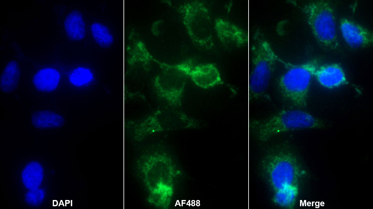 Monoclonal Antibody to Tumor Necrosis Factor Ligand Superfamily, Member 14 (TNFSF14)