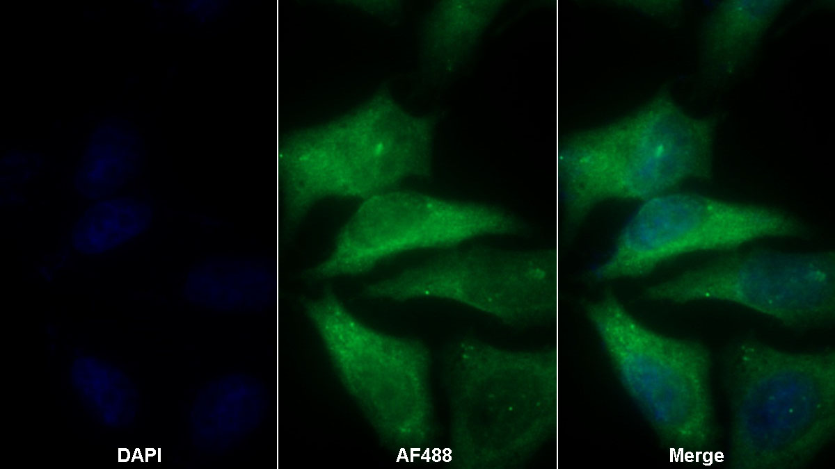 Monoclonal Antibody to Thrombin/Antithrombin Complex (TAT)