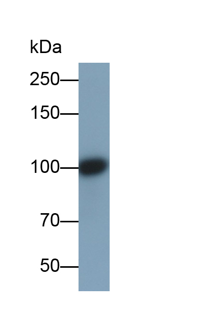 Monoclonal Antibody to Plasmin/Antiplasmin Complex (PAP)