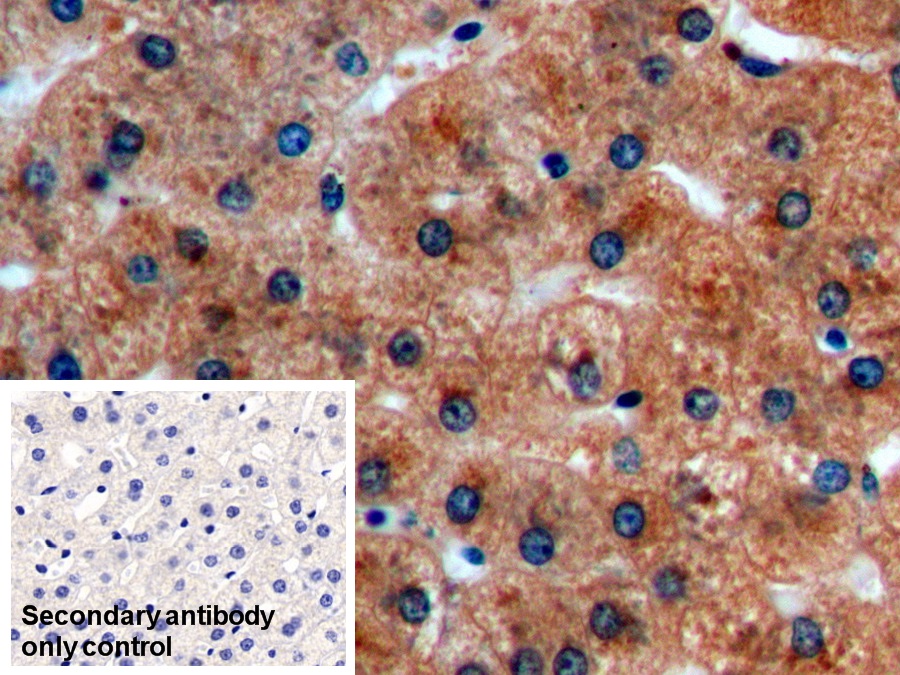 Monoclonal Antibody to Nitric Oxide Synthase 2, Inducible (NOS2)