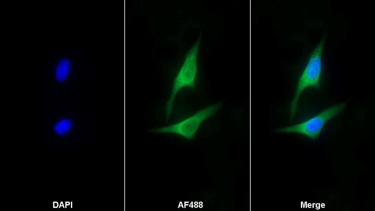 Monoclonal Antibody to Prolactin (PRL)