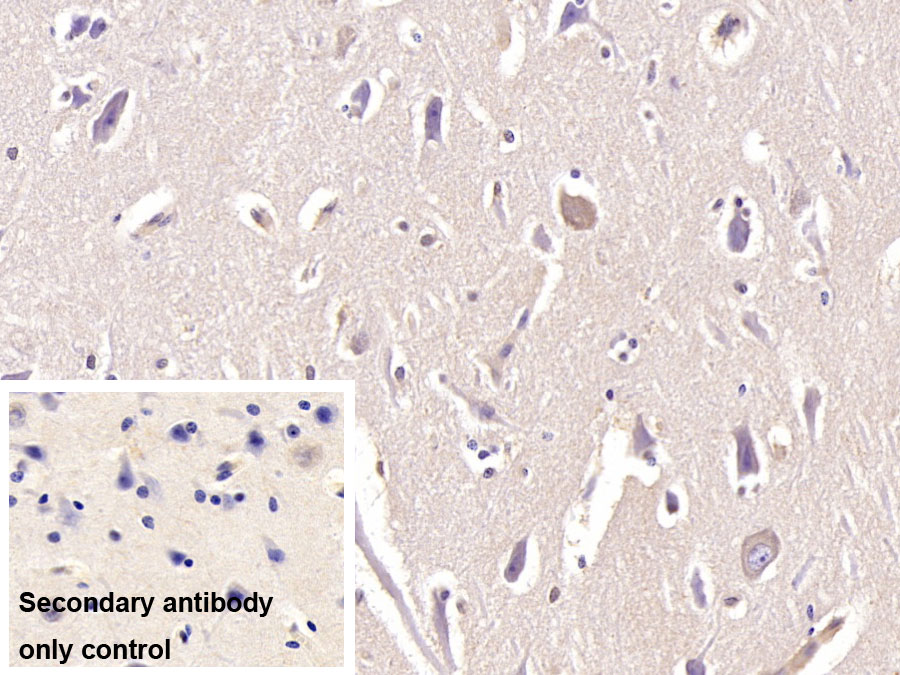 Monoclonal Antibody to Resistin (RETN)