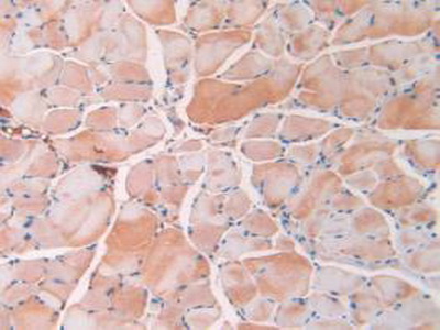 Monoclonal Antibody to Resistin (RETN)