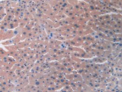 Monoclonal Antibody to Resistin (RETN)