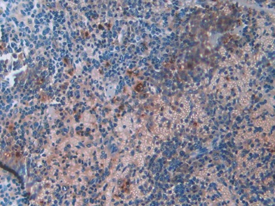 Monoclonal Antibody to Resistin (RETN)