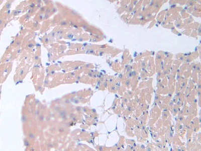 Monoclonal Antibody to Resistin (RETN)