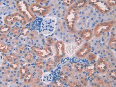 Monoclonal Antibody to Resistin (RETN)