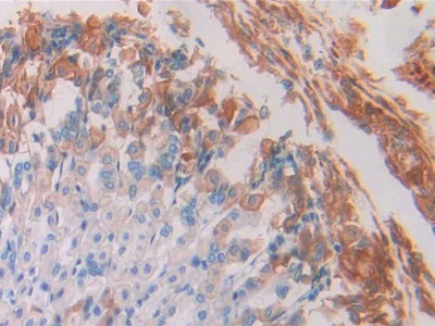 Monoclonal Antibody to Resistin (RETN)