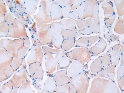 Monoclonal Antibody to Resistin (RETN)