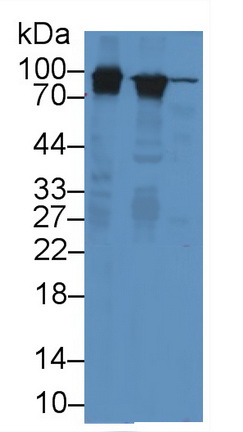 Monoclonal Antibody to Glycogen Phosphorylase, Liver (PYGL)