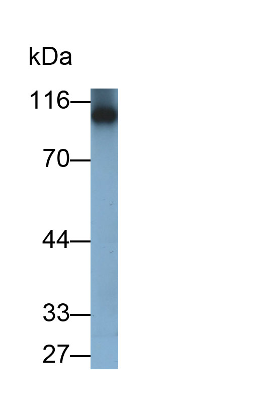 Monoclonal Antibody to Glycogen Phosphorylase, Liver (PYGL)