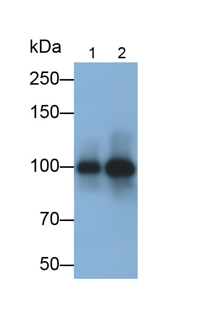 Monoclonal Antibody to Glycogen Phosphorylase, Liver (PYGL)