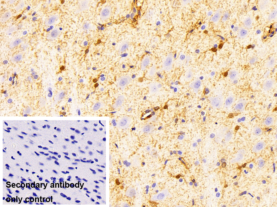 Monoclonal Antibody to Glycogen Phosphorylase, Liver (PYGL)