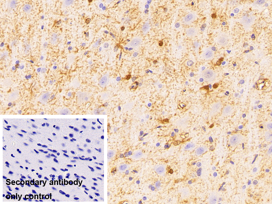 Monoclonal Antibody to Glycogen Phosphorylase, Liver (PYGL)