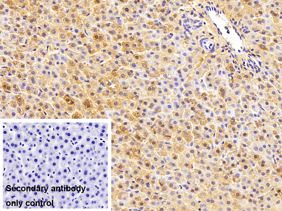 Monoclonal Antibody to Glycogen Phosphorylase, Liver (PYGL)