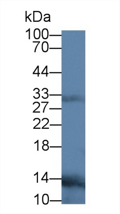 Monoclonal Antibody to Receptor Activator Of Nuclear Factor Kappa B Ligand (RANkL)