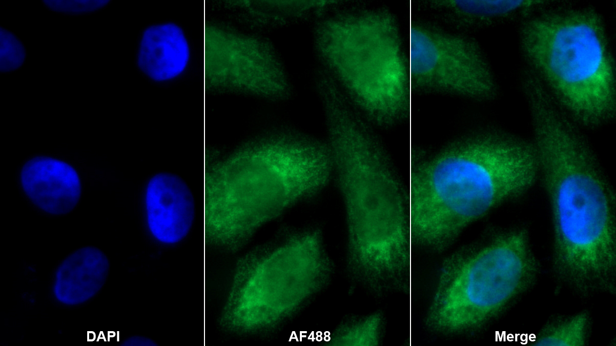 Monoclonal Antibody to Receptor Activator Of Nuclear Factor Kappa B Ligand (RANkL)