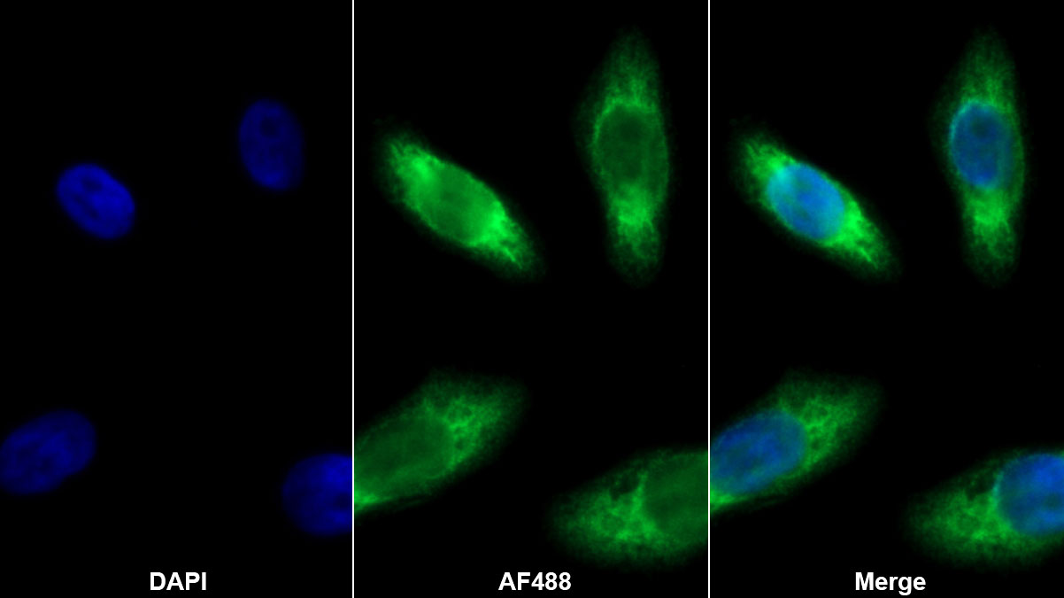 Monoclonal Antibody to Receptor Activator Of Nuclear Factor Kappa B Ligand (RANkL)