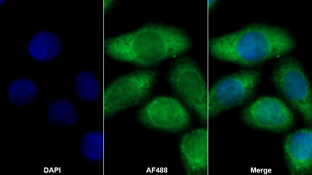 Monoclonal Antibody to Receptor Activator Of Nuclear Factor Kappa B Ligand (RANkL)