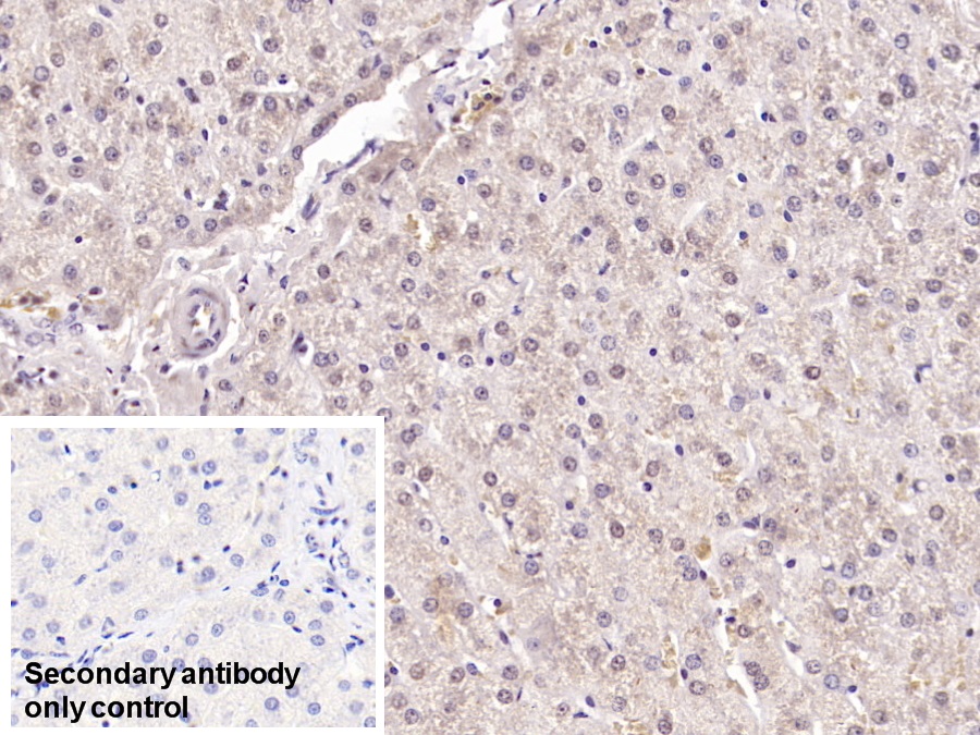 Monoclonal Antibody to Serum Amyloid A (SAA)