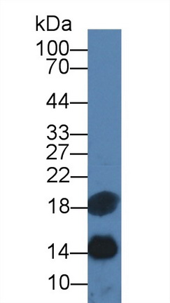 Monoclonal Antibody to Serum Amyloid A (SAA)