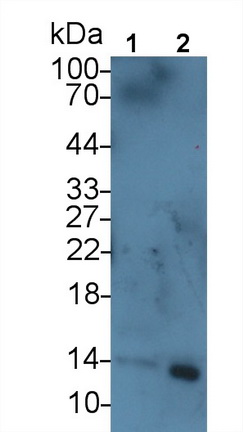 Monoclonal Antibody to Serum Amyloid A (SAA)