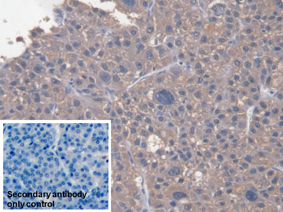 Monoclonal Antibody to Serum Amyloid A (SAA)