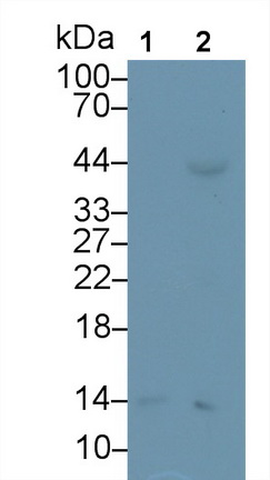 Monoclonal Antibody to Serum Amyloid A (SAA)