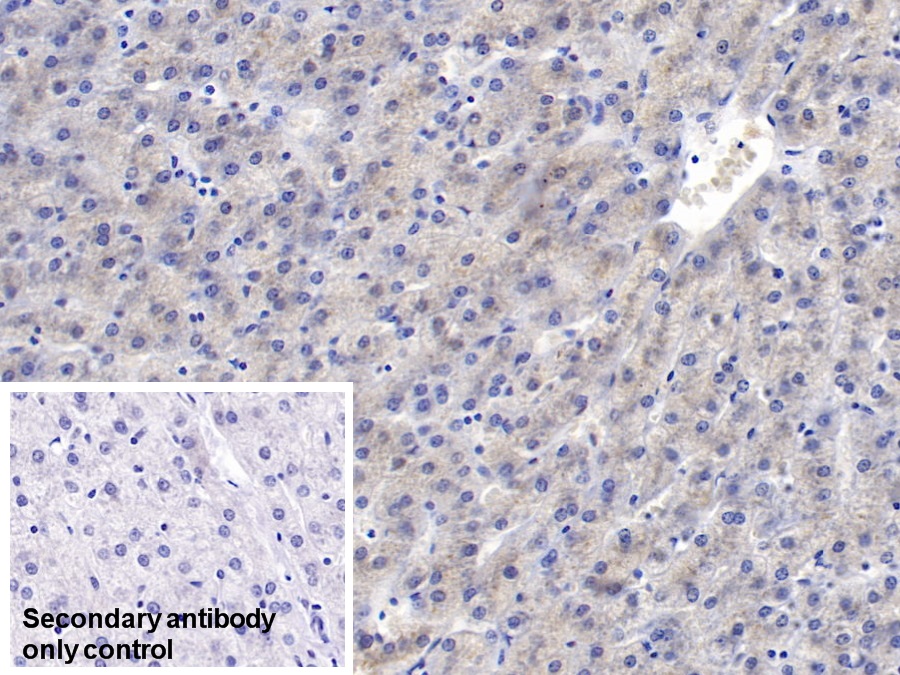 Monoclonal Antibody to Serum Amyloid A (SAA)