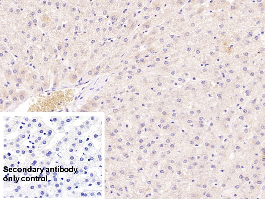 Monoclonal Antibody to Serum Amyloid A (SAA)