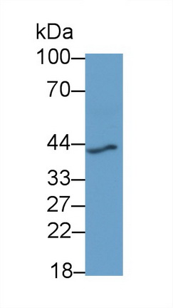 Monoclonal Antibody to Renin (REN)