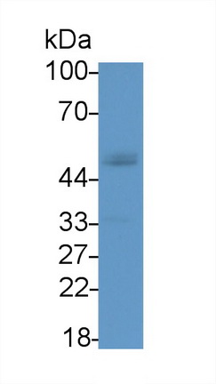 Monoclonal Antibody to Renin (REN)