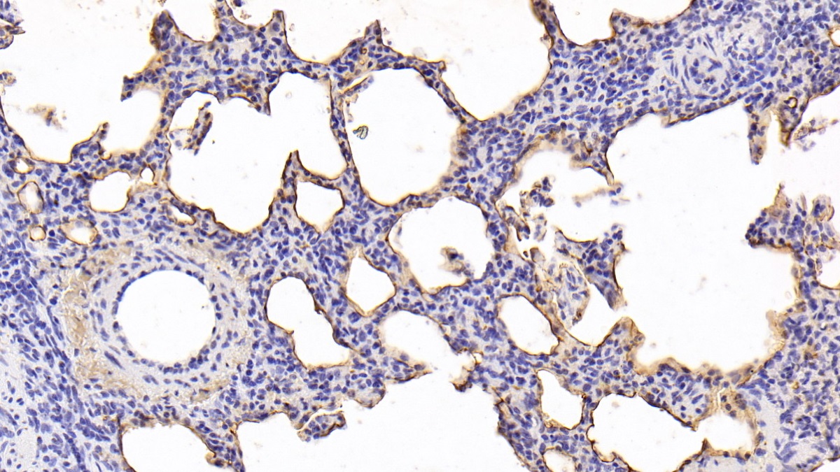 Monoclonal Antibody to Pulmonary Surfactant Associated Protein A1 (SFTPA1)