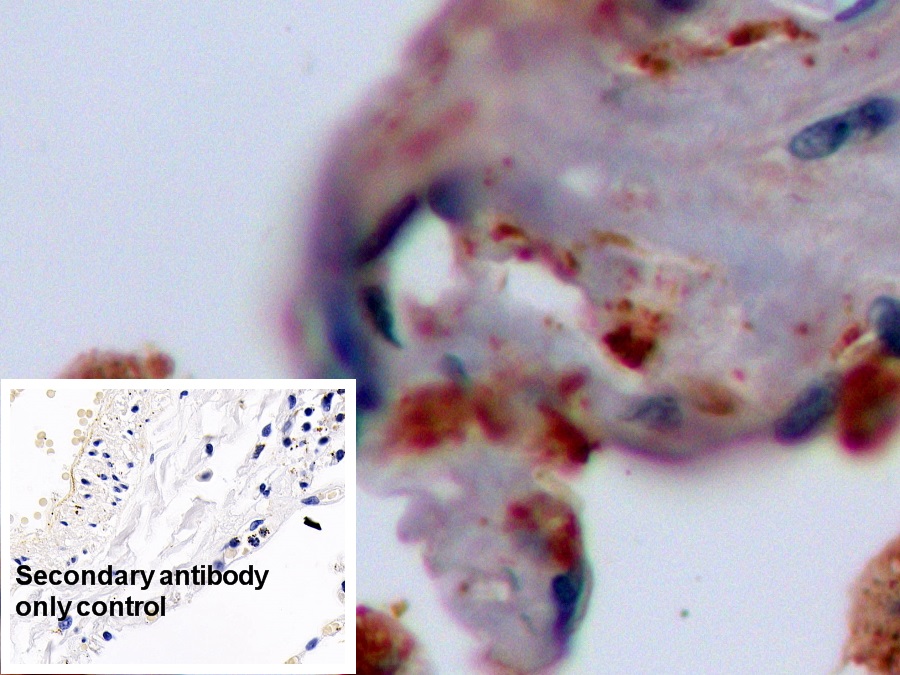 Monoclonal Antibody to Pulmonary Surfactant Associated Protein A1 (SFTPA1)