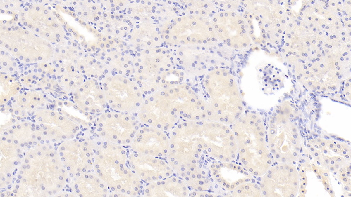 Monoclonal Antibody to Arachidonate-15-Lipoxygenase (ALOX15)