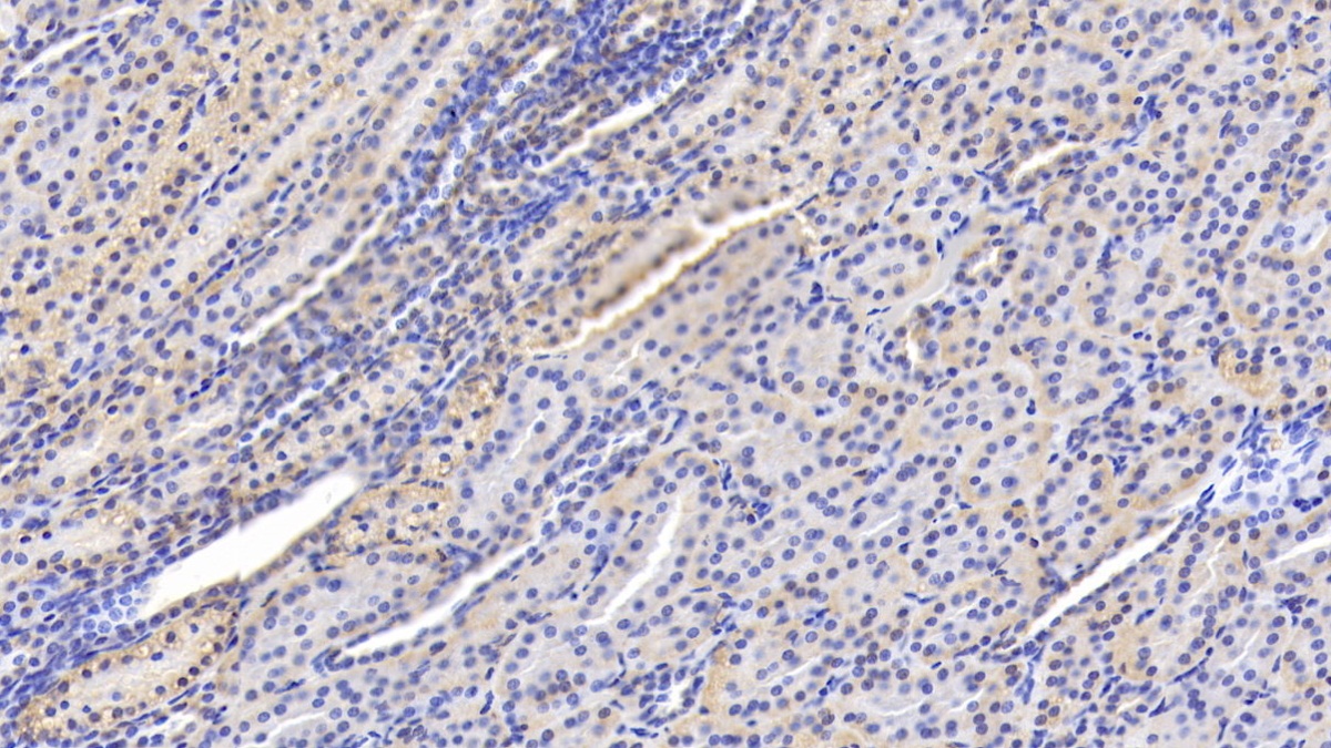 Monoclonal Antibody to Arachidonate-15-Lipoxygenase (ALOX15)