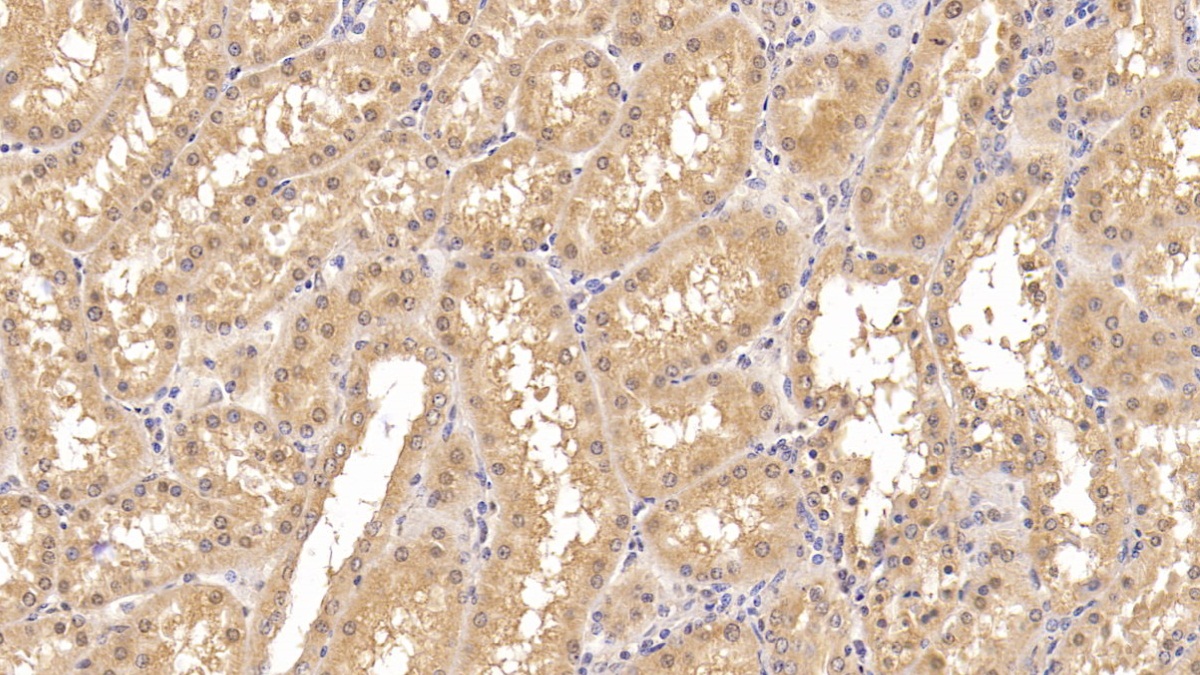 Monoclonal Antibody to Insulin Receptor (INSR)