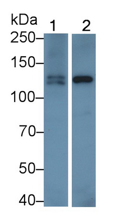 Monoclonal Antibody to Insulin Receptor (INSR)