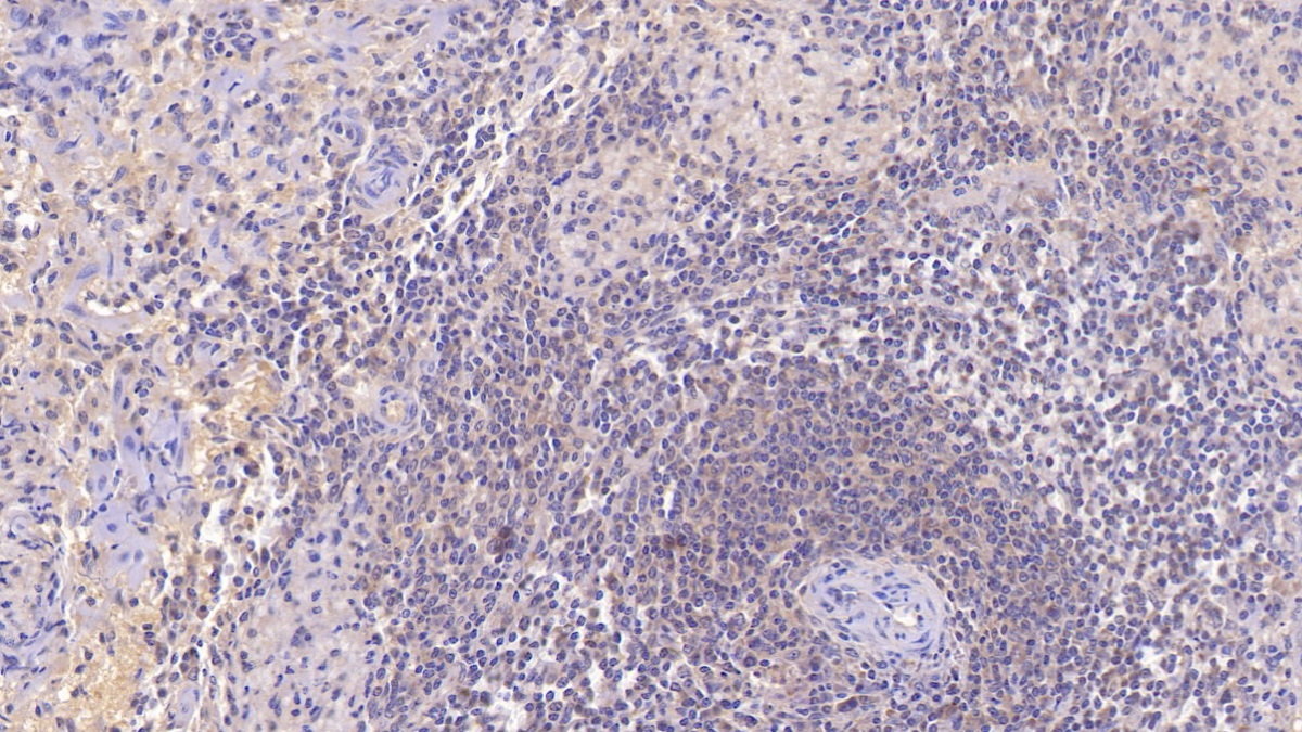 Monoclonal Antibody to Insulin Receptor (INSR)