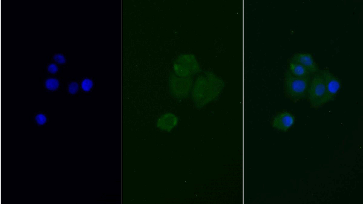 Monoclonal Antibody to Insulin Receptor (INSR)