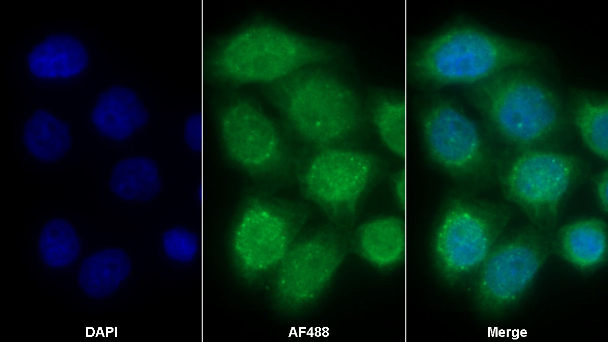 Monoclonal Antibody to Insulin Receptor (INSR)