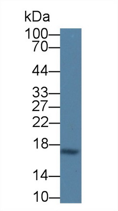 Monoclonal Antibody to Cystatin C (Cys-C)