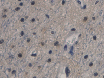 Monoclonal Antibody to Cystatin C (Cys-C)