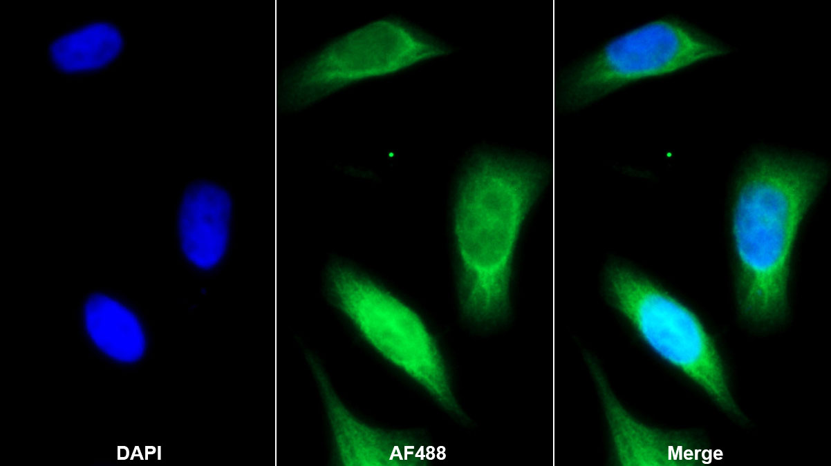 Monoclonal Antibody to Cystatin C (Cys-C)