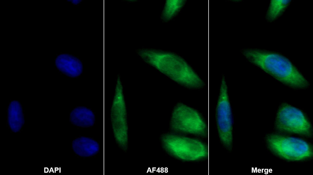 Monoclonal Antibody to Cystatin C (Cys-C)