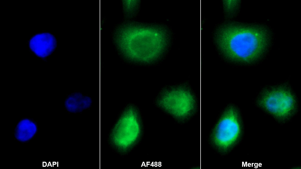 Monoclonal Antibody to Cystatin C (Cys-C)