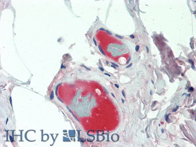 Monoclonal Antibody to Ceruloplasmin (CP)